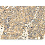Immunohistochemistry - UHRF1BP1 Antibody from Signalway Antibody (43177) - Antibodies.com