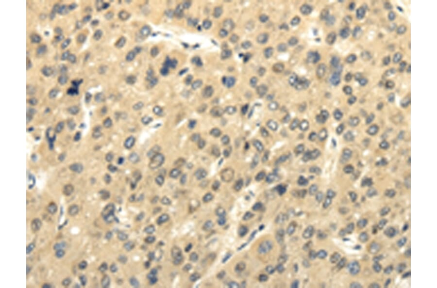 Immunohistochemistry - UHRF1BP1 Antibody from Signalway Antibody (43177) - Antibodies.com