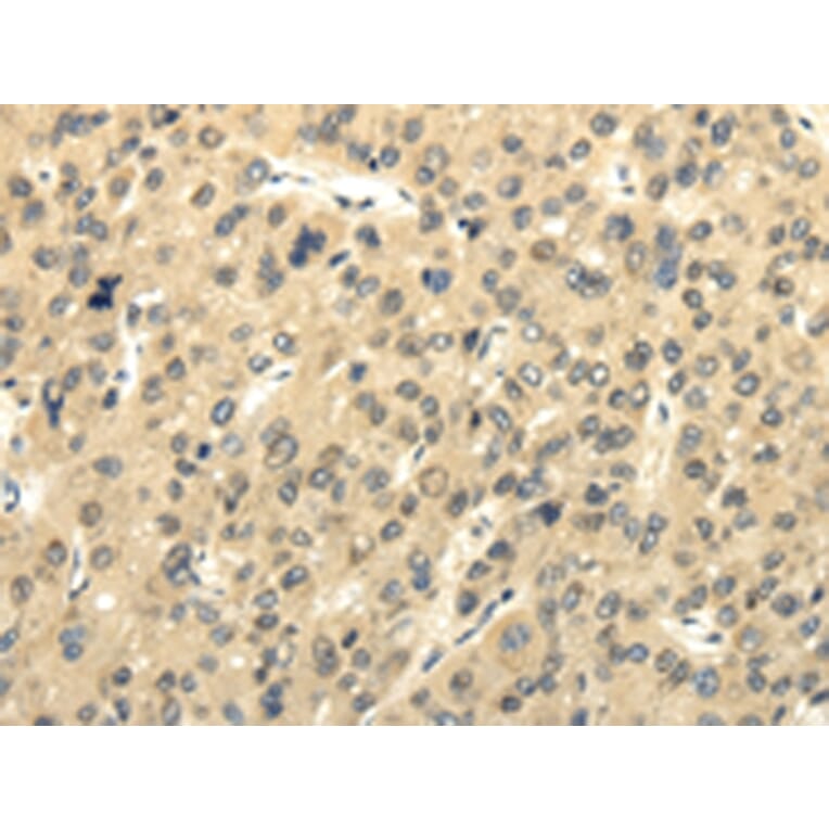 Immunohistochemistry - UHRF1BP1 Antibody from Signalway Antibody (43177) - Antibodies.com