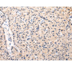 Immunohistochemistry - MUC1 (NT) Antibody from Signalway Antibody (43221) - Antibodies.com
