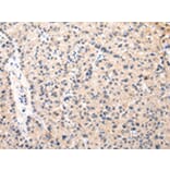 Immunohistochemistry - MUC1 (NT) Antibody from Signalway Antibody (43221) - Antibodies.com