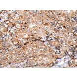 Immunohistochemistry - MUC1 (CT) Antibody from Signalway Antibody (43222) - Antibodies.com