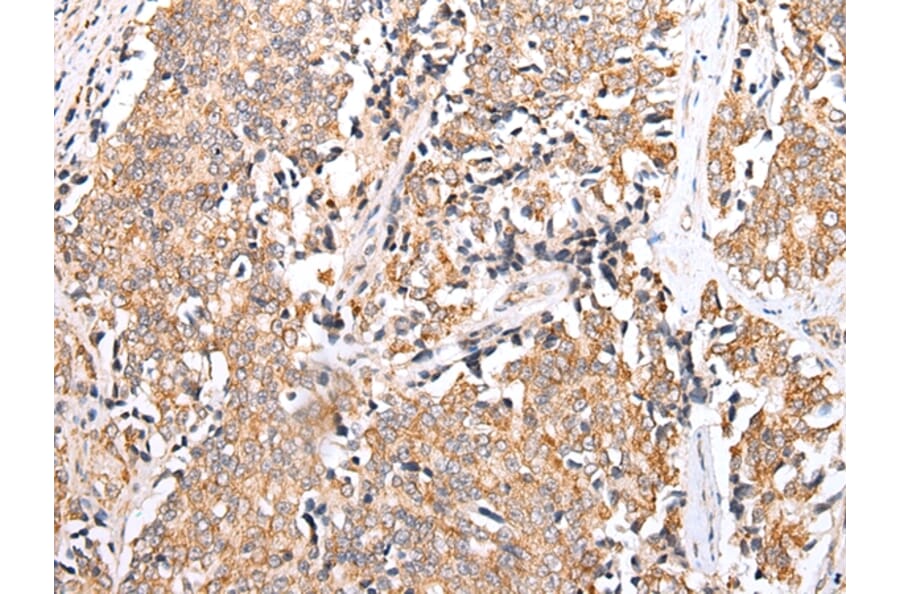 Immunohistochemistry - PPP1R15A Antibody from Signalway Antibody (43273) - Antibodies.com