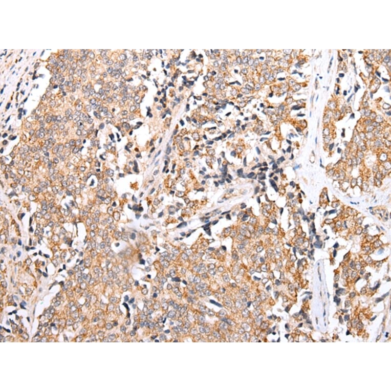 Immunohistochemistry - PPP1R15A Antibody from Signalway Antibody (43273) - Antibodies.com