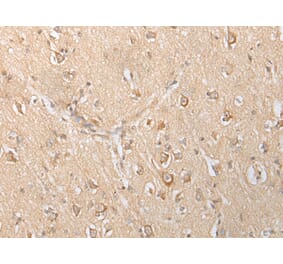 Immunohistochemistry - SLC25A21 Antibody from Signalway Antibody (43305) - Antibodies.com