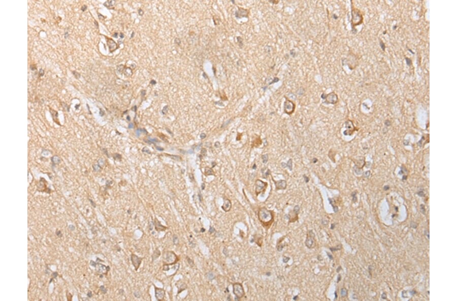 Immunohistochemistry - SLC25A21 Antibody from Signalway Antibody (43305) - Antibodies.com