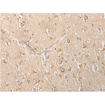 Immunohistochemistry - SLC25A21 Antibody from Signalway Antibody (43305) - Antibodies.com