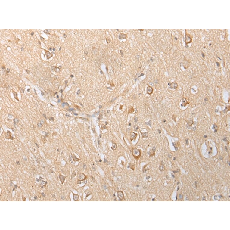 Immunohistochemistry - SLC25A21 Antibody from Signalway Antibody (43305) - Antibodies.com