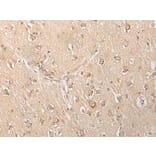 Immunohistochemistry - SLC25A21 Antibody from Signalway Antibody (43305) - Antibodies.com