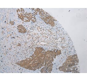 Immunohistochemistry - PLA2G12A Antibody from Signalway Antibody (43382) - Antibodies.com