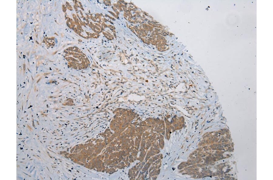 Immunohistochemistry - PLA2G12A Antibody from Signalway Antibody (43382) - Antibodies.com