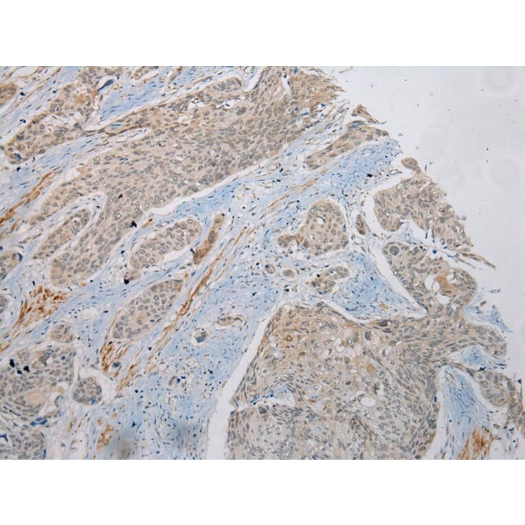 Immunohistochemistry - PLA2G12A Antibody from Signalway Antibody (43382) - Antibodies.com