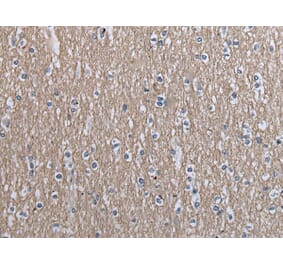 SLC39A14 Antibody from Signalway Antibody (43538) - Antibodies.com