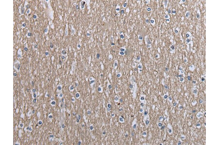 SLC39A14 Antibody from Signalway Antibody (43538) - Antibodies.com