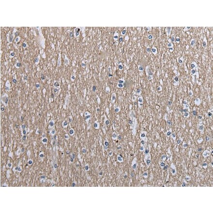 SLC39A14 Antibody from Signalway Antibody (43538) - Antibodies.com