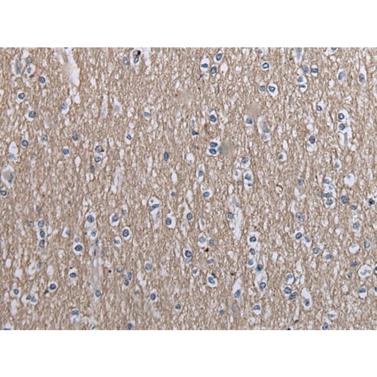 SLC39A14 Antibody from Signalway Antibody (43538) - Antibodies.com