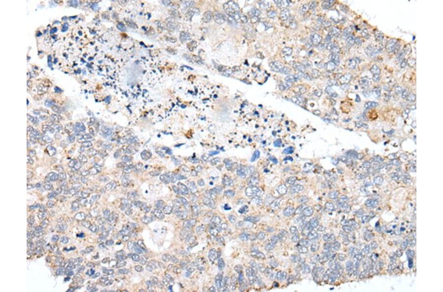 PDCD6IP Antibody from Signalway Antibody (43629) - Antibodies.com