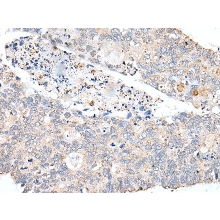 PDCD6IP Antibody from Signalway Antibody (43629) - Antibodies.com