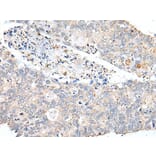 PDCD6IP Antibody from Signalway Antibody (43629) - Antibodies.com