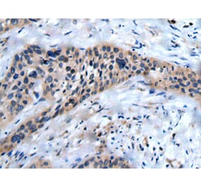 SLC17A8 Antibody from Signalway Antibody (43822) - Antibodies.com