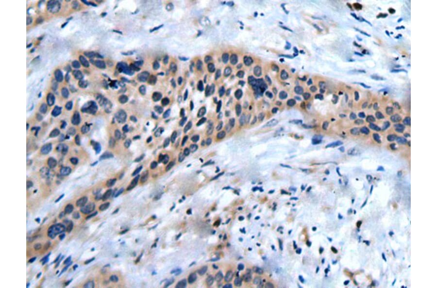 SLC17A8 Antibody from Signalway Antibody (43822) - Antibodies.com