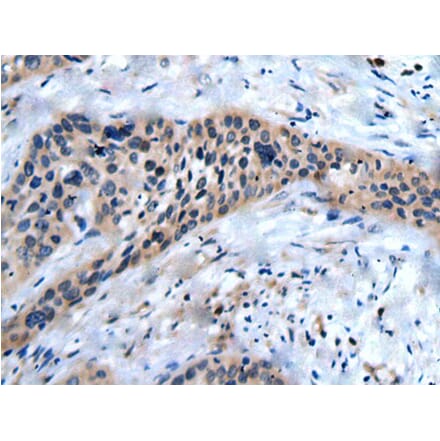 SLC17A8 Antibody from Signalway Antibody (43822) - Antibodies.com