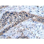 SLC17A8 Antibody from Signalway Antibody (43822) - Antibodies.com