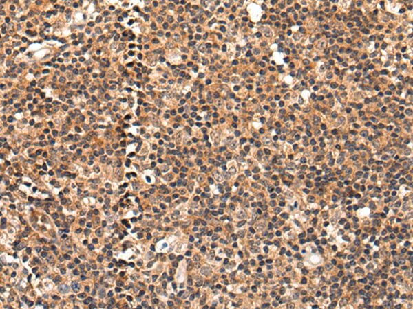 The image on the left is immunohistochemistry of paraffin-embedded Human tonsil tissue using C16orf45 Antibody at dilution 1/45, on the right is treated with synthetic peptide. (Original magnification: x200)