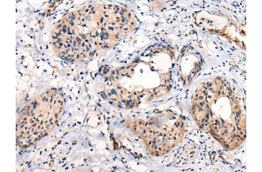C16orf45 Antibody from Signalway Antibody (43870) - Antibodies.com