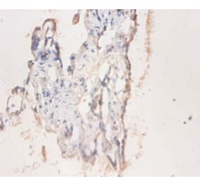 Immunohistochemistry - CD59 glycoprotein Polyclonal Antibody from Signalway Antibody (42110) - Antibodies.com