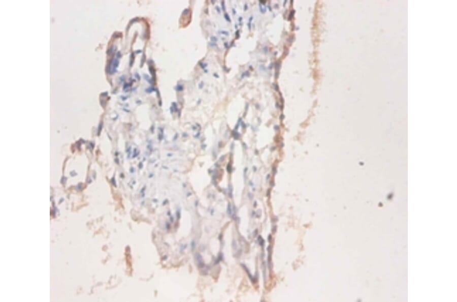 Immunohistochemistry - CD59 glycoprotein Polyclonal Antibody from Signalway Antibody (42110) - Antibodies.com