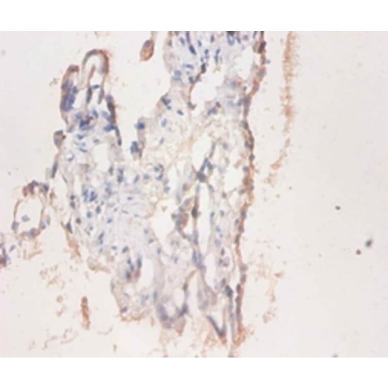 Immunohistochemistry - CD59 glycoprotein Polyclonal Antibody from Signalway Antibody (42110) - Antibodies.com