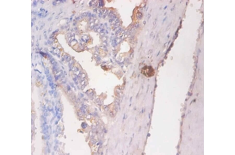 Immunohistochemistry - CD59 glycoprotein Polyclonal Antibody from Signalway Antibody (42110) - Antibodies.com
