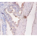 Immunohistochemistry - CD59 glycoprotein Polyclonal Antibody from Signalway Antibody (42110) - Antibodies.com