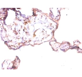 Immunohistochemistry - Prothymosin alpha Polyclonal Antibody from Signalway Antibody (42262) - Antibodies.com