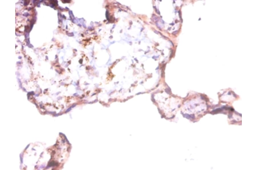 Immunohistochemistry - Prothymosin alpha Polyclonal Antibody from Signalway Antibody (42262) - Antibodies.com