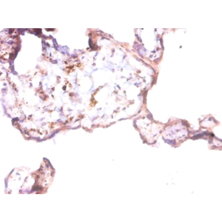Immunohistochemistry - Prothymosin alpha Polyclonal Antibody from Signalway Antibody (42262) - Antibodies.com