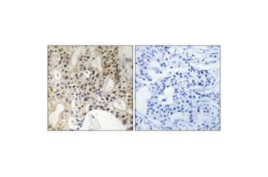 Immunohistochemistry - LATS1/2 Antibody from Signalway Antibody (33232) - Antibodies.com