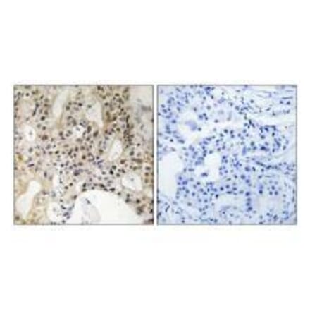 Immunohistochemistry - LATS1/2 Antibody from Signalway Antibody (33232) - Antibodies.com