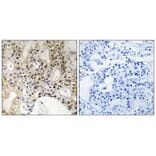 Immunohistochemistry - LATS1/2 Antibody from Signalway Antibody (33232) - Antibodies.com