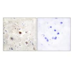 Immunohistochemistry - p57KIP2 Antibody from Signalway Antibody (33788) - Antibodies.com