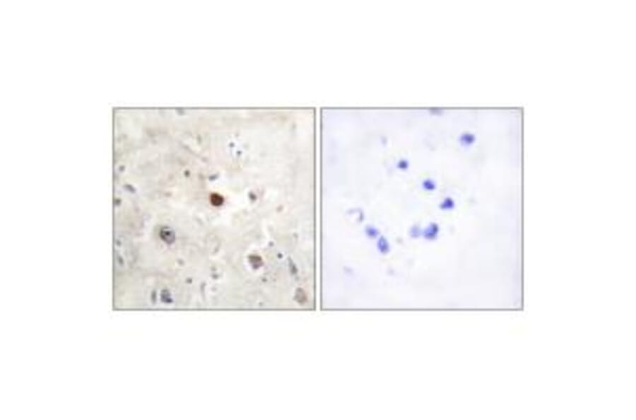 Immunohistochemistry - p57KIP2 Antibody from Signalway Antibody (33788) - Antibodies.com