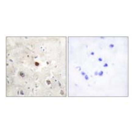 Immunohistochemistry - p57KIP2 Antibody from Signalway Antibody (33788) - Antibodies.com