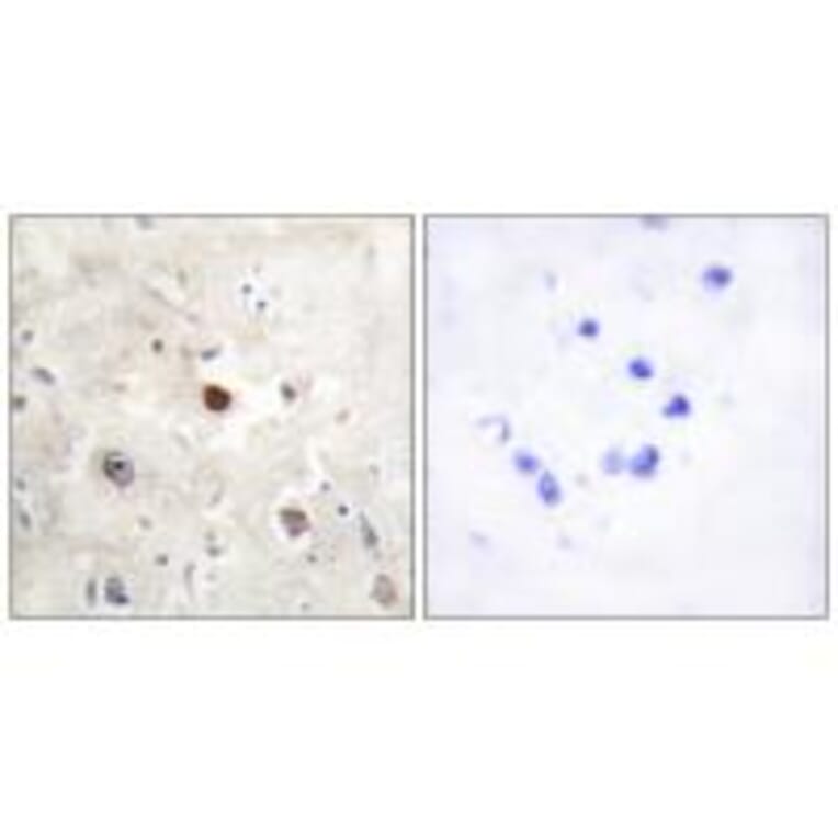 Immunohistochemistry - p57KIP2 Antibody from Signalway Antibody (33788) - Antibodies.com