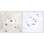 Immunohistochemistry - p57KIP2 Antibody from Signalway Antibody (33788) - Antibodies.com