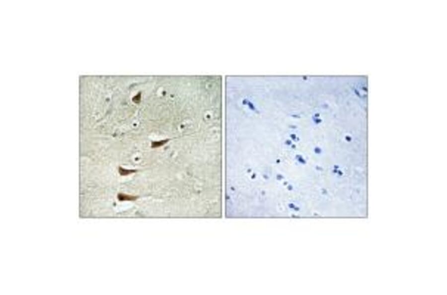 Immunohistochemistry - MAP3K10 Antibody from Signalway Antibody (33848) - Antibodies.com