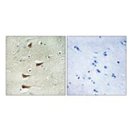 Immunohistochemistry - MAP3K10 Antibody from Signalway Antibody (33848) - Antibodies.com