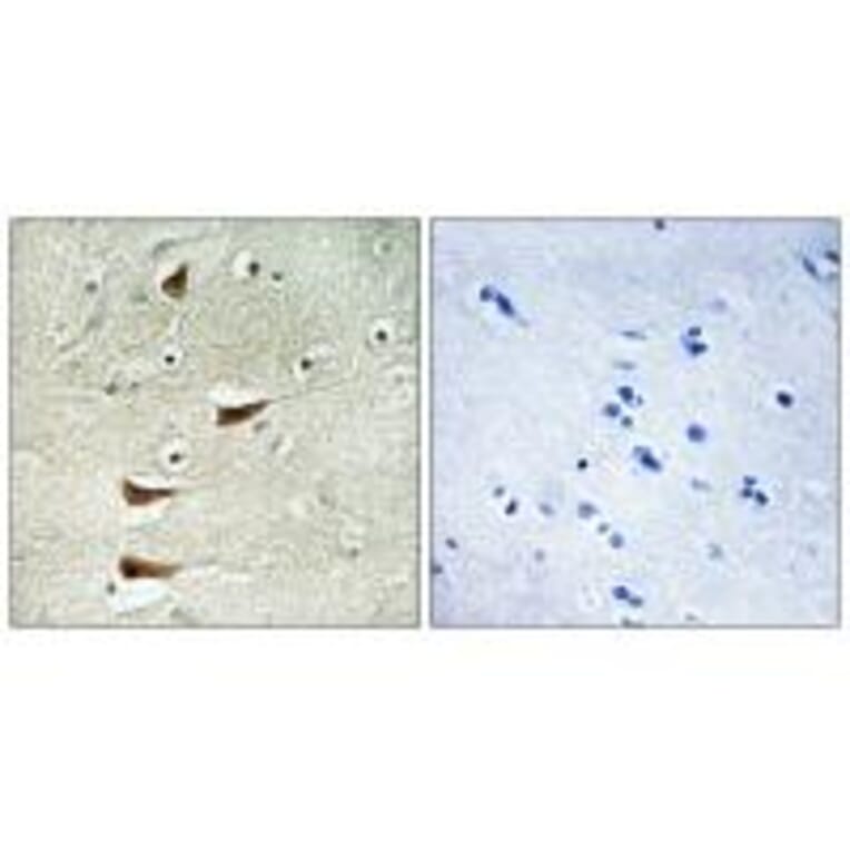 Immunohistochemistry - MAP3K10 Antibody from Signalway Antibody (33848) - Antibodies.com