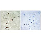 Immunohistochemistry - MAP3K10 Antibody from Signalway Antibody (33848) - Antibodies.com