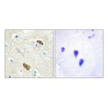 Immunohistochemistry - PLXDC1 Antibody from Signalway Antibody (33956) - Antibodies.com
